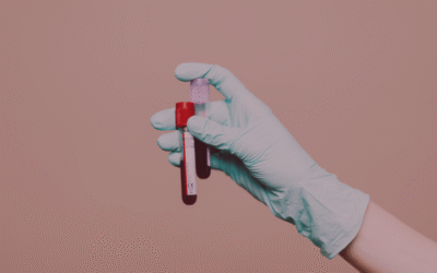 Homocysteine: The Overlooked Marker That Affects Your Mood, Memory & Hormones