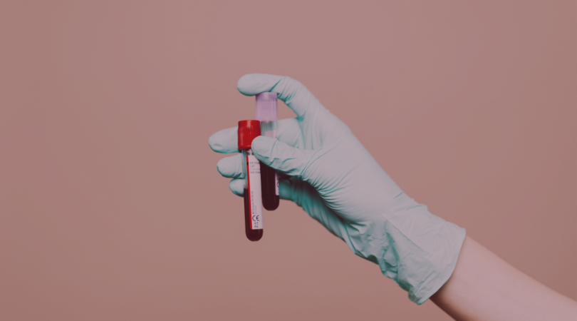 Homocysteine: The Overlooked Marker That Affects Your Mood, Memory & Hormones